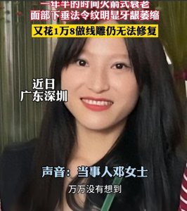 ​女子花高价做磨骨手术，颧骨被全部拿掉！前后对比图惊呆网友圈!